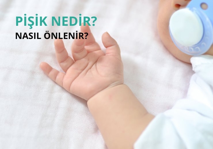 Pişik Nedir?